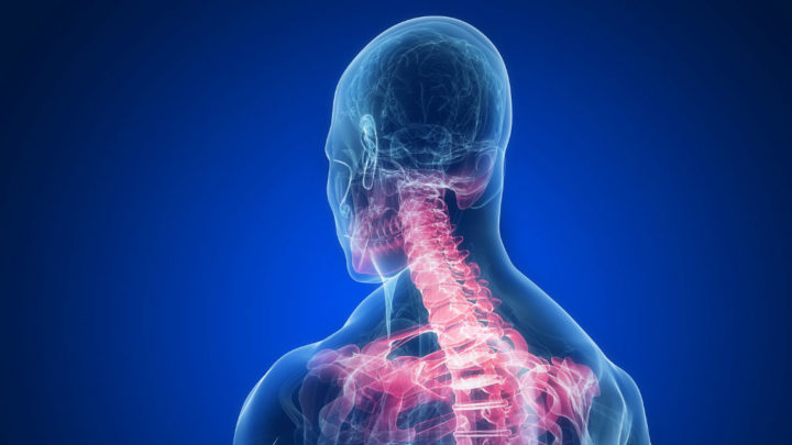 How to Identify Whiplash